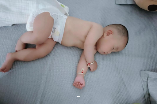 广州宝宝脸上有白色斑块